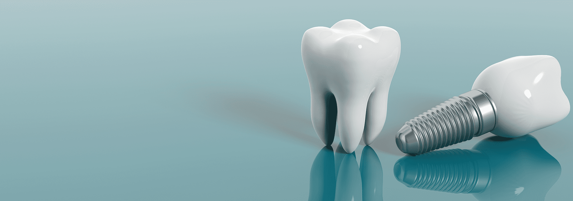 Image numérique d'une dent saine et d'un implant dentaire